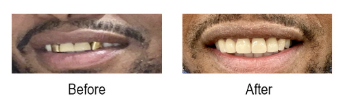 изображение 2025 01 24 1904551887 копия - Coastal Cosmetic and Family Dentistry , FL