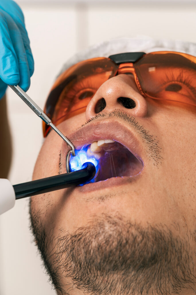 Vertical photo of a dentist whitening a patient's teeth with laser in a clinic