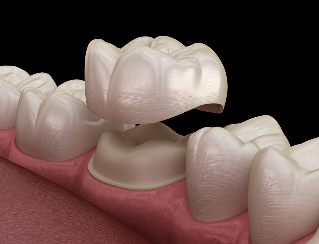 AdobeStock 264943756 - Coastal Cosmetic and Family Dentistry , FL