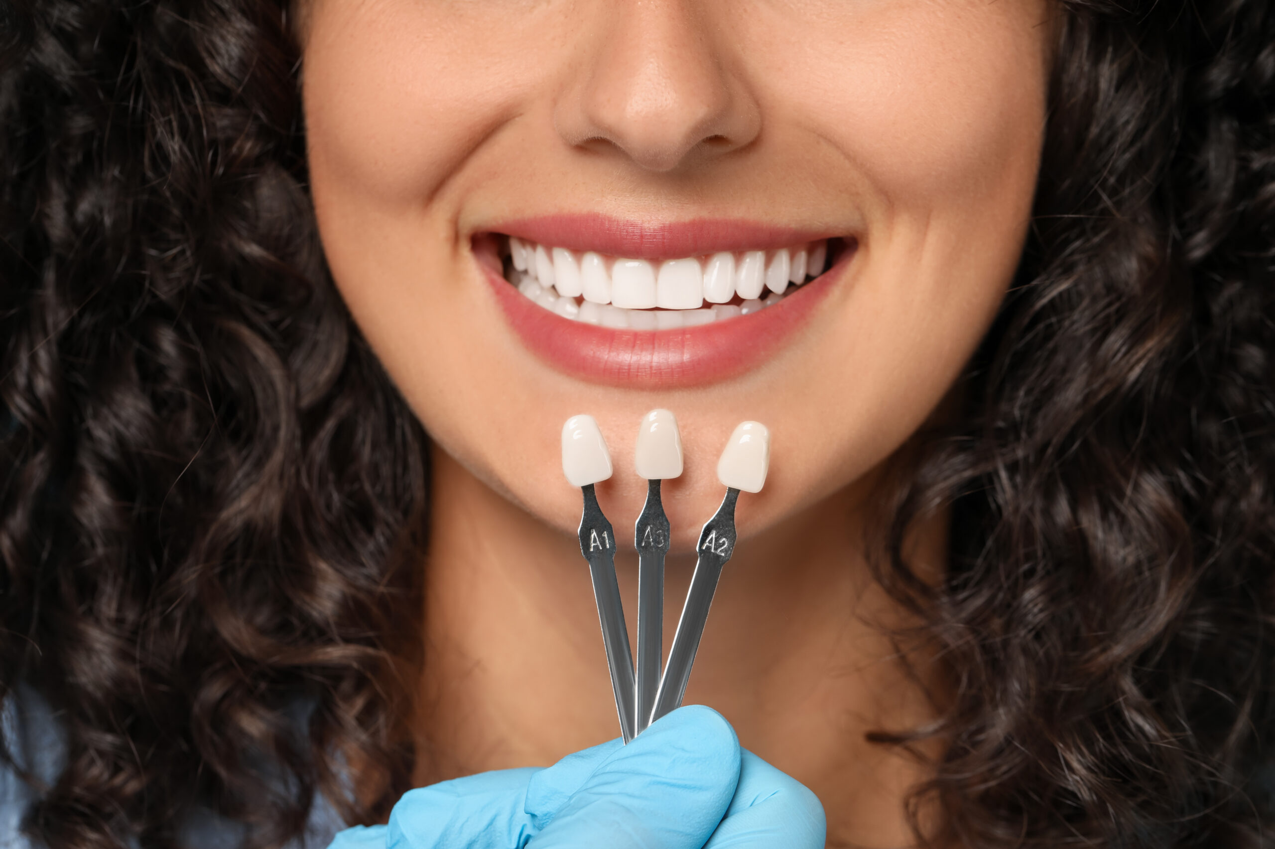 Doctor checking a young woman's teeth color for dental veneers treatment
