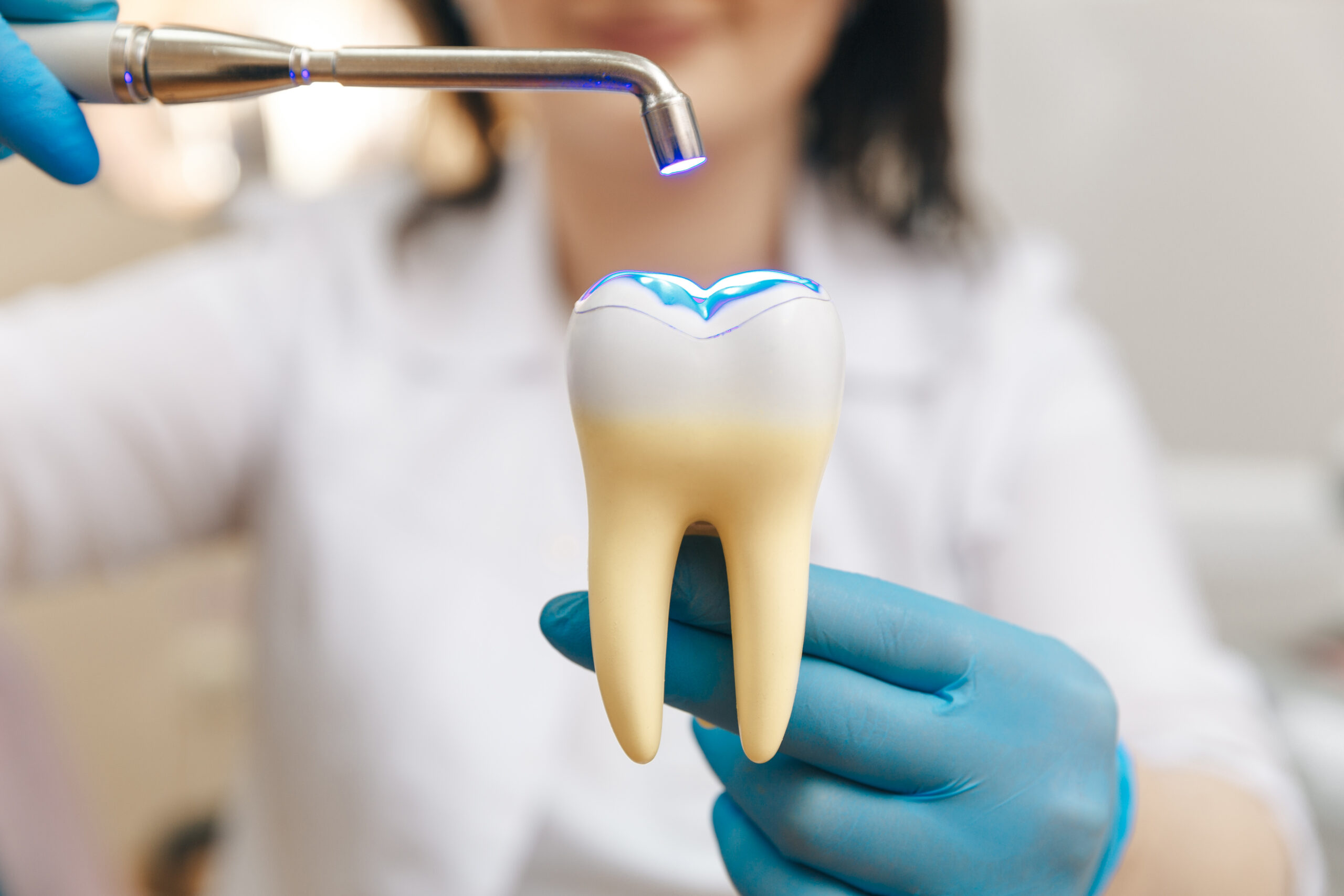 Dental restoration process showing an inlay or onlay being fitted on a tooth model