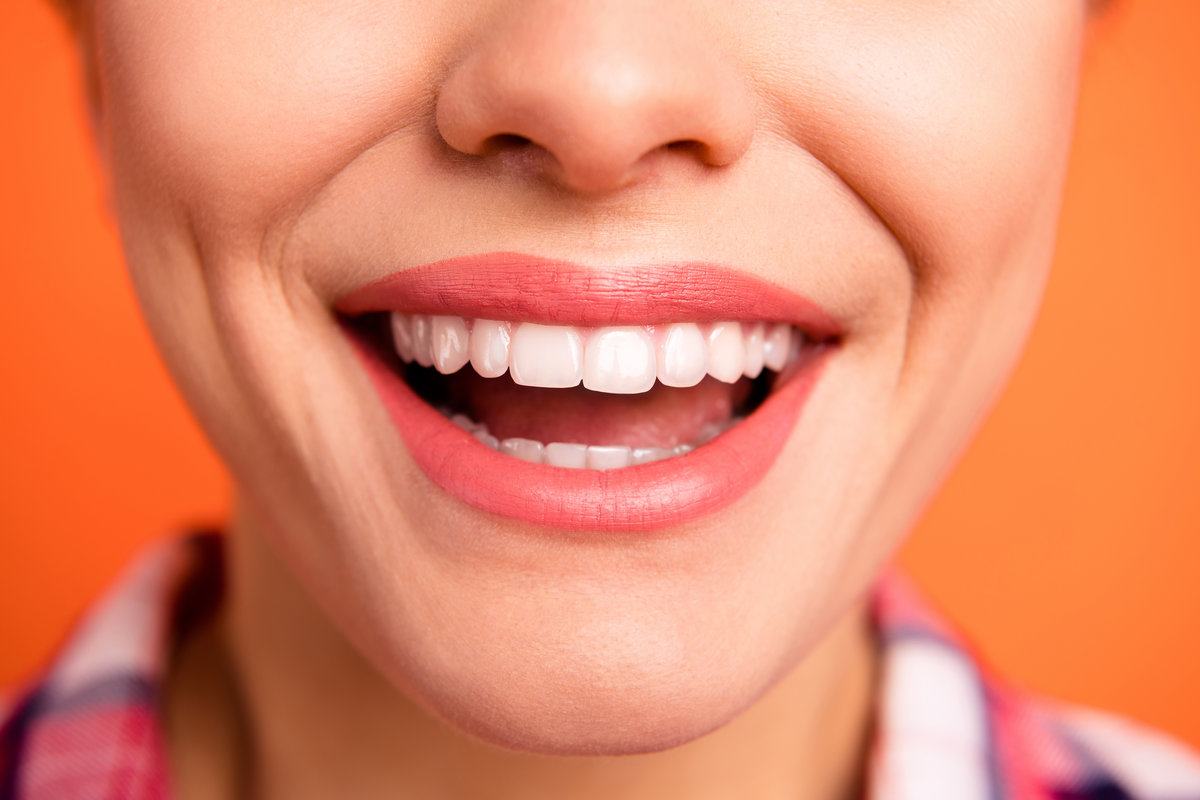 Cropped close up view photo of lovely funny funky lady she her show tooth dentist procedures have checkered shirt checked plaid isolated orange background