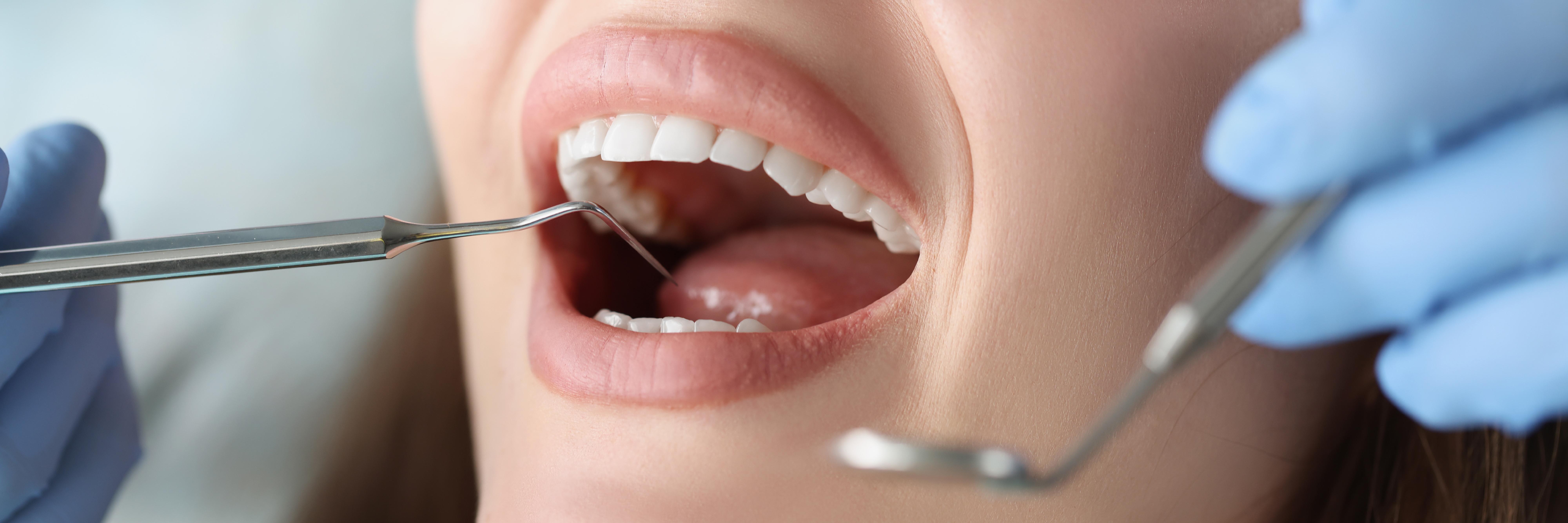 Dentist examining a patient's tooth during a dental checkup