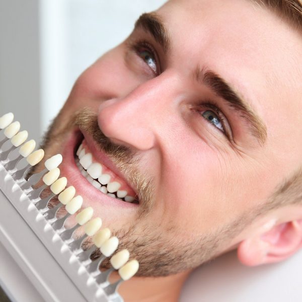 Young man choosing color of teeth at dentist